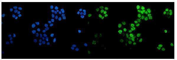pa2056 tp63 primary antibodies if testing 6_1