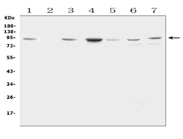 Western blot analysis of Factor VIII using anti-Factor VIII antibody (PA2061). Electrophoresis was performed on a 5-20% SDS-PAGE gel at 70V (Stacking gel) / 90V (Resolving gel) for 2-3 hours. The sample well of each lane was loaded with 50ug of sample under reducing conditions. Lane 1: rat kidney tissue lysates, Lane 2: rat lung tissue lysates, Lane 3: rat heart tissue lysates, Lane 4: mouse kidney tissue lysates, Lane 5: mouse lung tissue lysates, Lane 6: human Hela whole cell lysates, Lane 7: human HepG2 whole cell lysates, After Electrophoresis, proteins were transferred to a Nitrocellulose membrane at 150mA for 50-90 minutes. Blocked the membrane with 5% Non-fat Milk/ TBS for 1.5 hour at RT. The membrane was incubated with rabbit anti-Factor VIII antigen affinity purified polyclonal antibody (Catalog # PA2061) at 0.5 μg/mL overnight at 4°C, then washed with TBS-0.1%Tween 3 times with 5 minutes each and probed with a goat anti-rabbit IgG-HRP secondary antibody at a dilution of 1:10000 for 1.5 hour at RT. The signal is developed using an Enhanced Chemiluminescent detection (ECL) kit (Catalog # EK1002) with Tanon 5200 system. A specific band was detected for Factor VIII at approximately 92KD. The expected band size for Factor VIII is at 92KD.