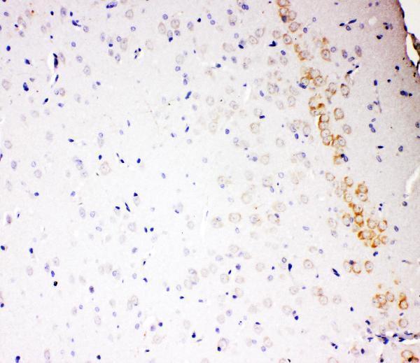  IHC analysis of ALDH2 using anti-ALDH2 antibody (PA2073)