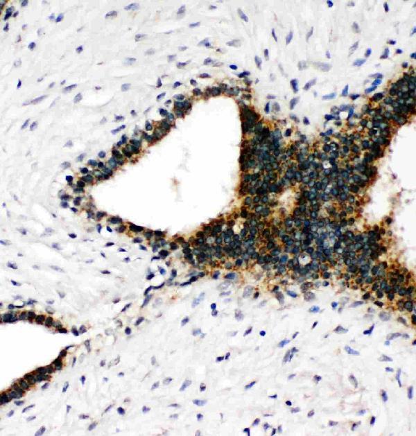 pa2076 2 ihc anti annexin vii antibody