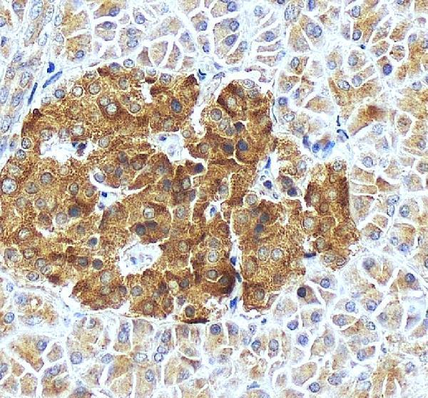 pa2084 pcsk1 primary antibodies ihc testing 3