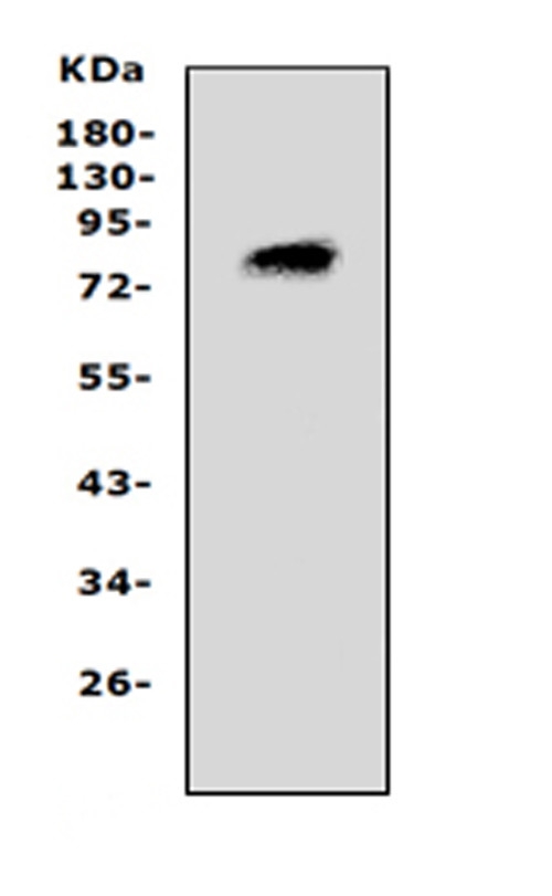 Western blot analysis of PCSK4 using anti-PCSK4 antibody (PA2086). Electrophoresis was performed on a 5-20% SDS-PAGE gel at 70V (Stacking gel) / 90V (Resolving gel) for 2-3 hours. The sample well of each lane was loaded with 50ug of sample under reducing conditions. Lane 1: rat brain lysates. After Electrophoresis, proteins were transferred to a Nitrocellulose membrane at 150mA for 50-90 minutes. Blocked the membrane with 5% Non-fat Milk/ TBS for 1.5 hour at RT. The membrane was incubated with rabbit anti-PCSK4 antigen affinity purified polyclonal antibody (Catalog # PA2086) at 0.5 μg/mL overnight at 4°C, then washed with TBS-0.1%Tween 3 times with 5 minutes each and probed with a goat anti-rabbit IgG-HRP secondary antibody at a dilution of 1:10000 for 1.5 hour at RT. The signal is developed using an Enhanced Chemiluminescent detection (ECL) kit (Catalog # EK1002) with Tanon 5200 system. A specific band was detected for PCSK4 at approximately 83KD. The expected band size for PCSK4 is at 83KD.