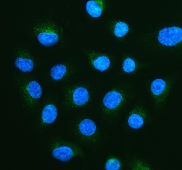 pa2091 abcd3 primary antibodies if testing 1