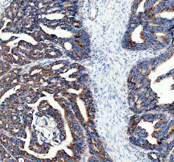 pa2091 abcd3 primary antibodies ihc testing 1
