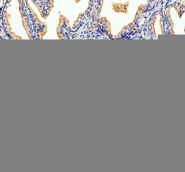 pa2091 abcd3 primary antibodies ihc testing 2