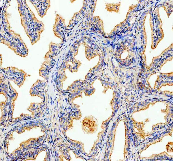 pa2091 abcd3 primary antibodies ihc testing 2_1