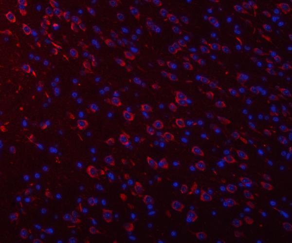 pa2098 atxn2 primary antibodies if testing 6