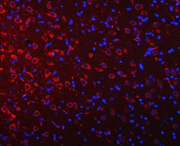 pa2098 atxn2 primary antibodies if testing 7