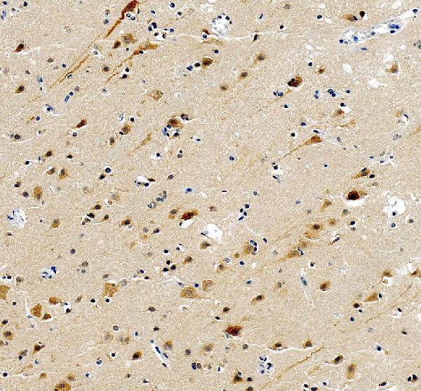 IHC analysis of ATXN2 using anti-ATXN2 antibody (PA2098)