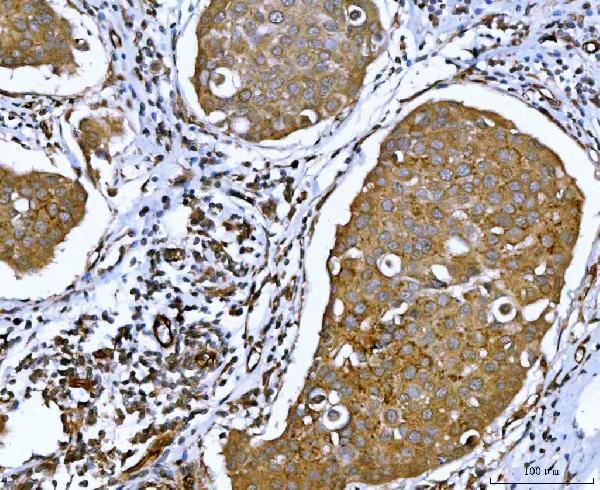pa2098 atxn2 primary antibodies ihc testing 2