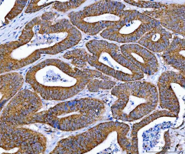 pa2098 atxn2 primary antibodies ihc testing 3