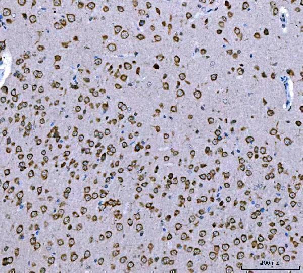 pa2098 atxn2 primary antibodies ihc testing 4