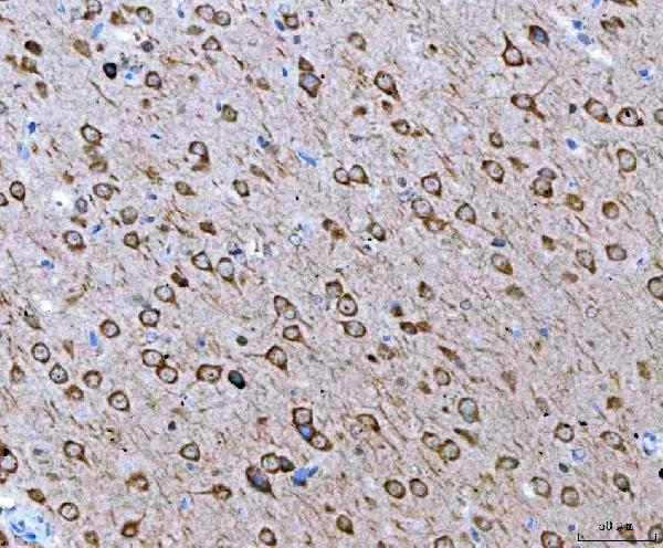 pa2098 atxn2 primary antibodies ihc testing 5