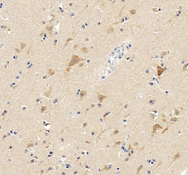 IHC analysis of Ataxin 2/ATXN2 using anti-Ataxin 2/ATXN2 antibody (PA2098)