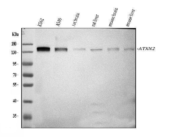  Western blot analysis of ATXN2 using anti-ATXN2 antibody (PA2098)