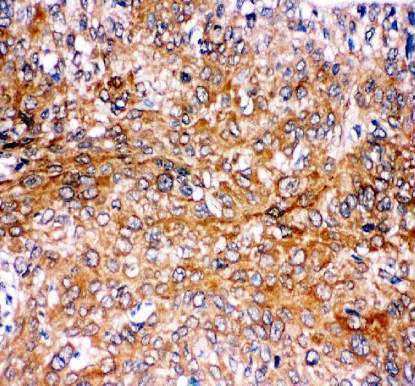 pa2106 cstb primary antibodies ihc testing 1