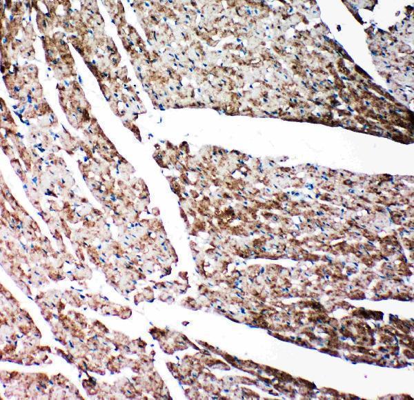 pa2109 4 ihc anti gelsolin antibody