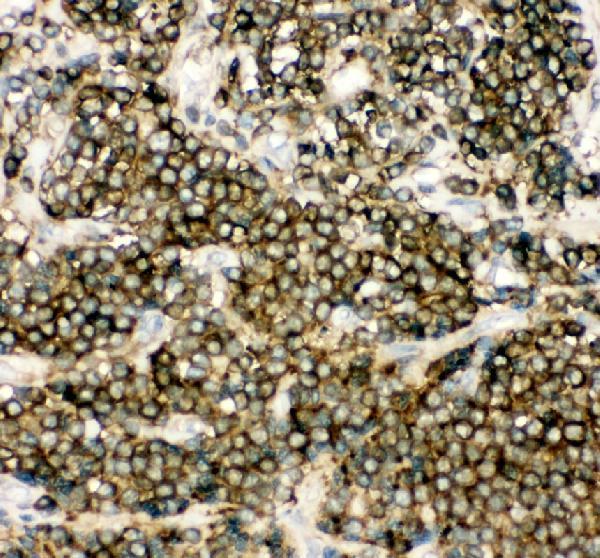 pa2111 nfkb1 primary antibodies ihc testing 1