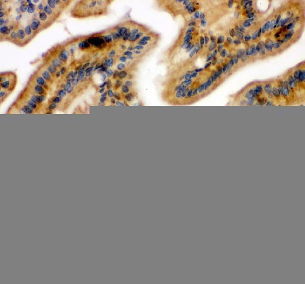 pa2111 nfkb1 primary antibodies ihc testing 2