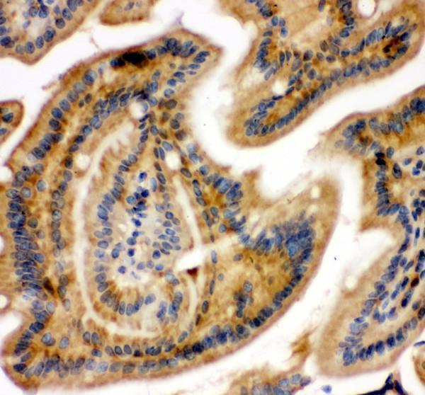 pa2111 nfkb1 primary antibodies ihc testing 2_1