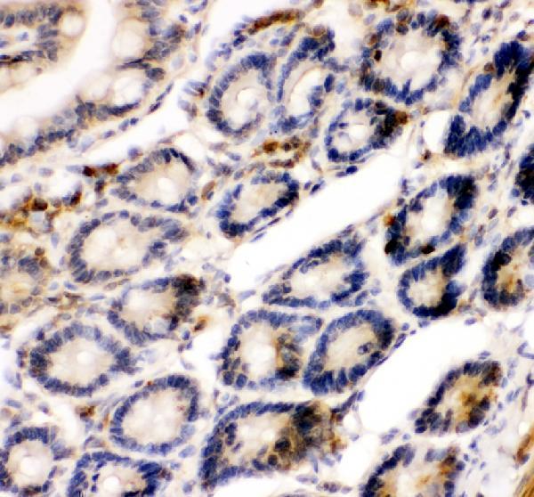 pa2111 nfkb1 primary antibodies ihc testing 3
