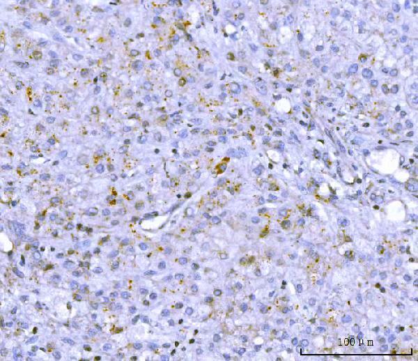 pa2130 pcsk9 primary antibodies ihc testing 2