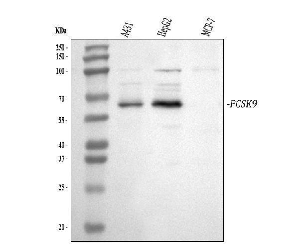 pa2130 pcsk9 primary antibodies wb testing 1_1