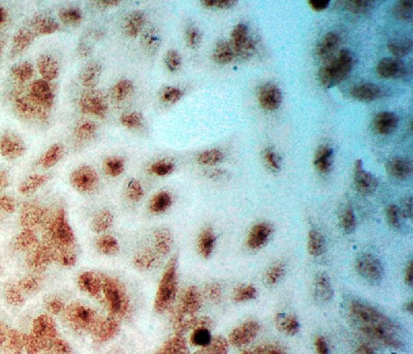 pa2131 plk2 primary antibodies icc testing 6