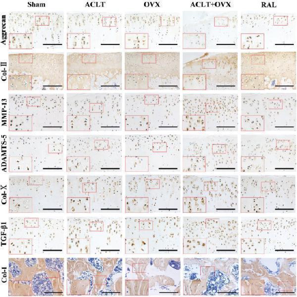 RAL preserved the matrix of cartilage and bone and inhibited the overexpression of TGF-β1 and catabolic factors