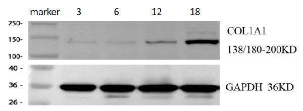  Western blot analysis of COL1A1 using anti-COL1A1 antibody (PA2140-1)