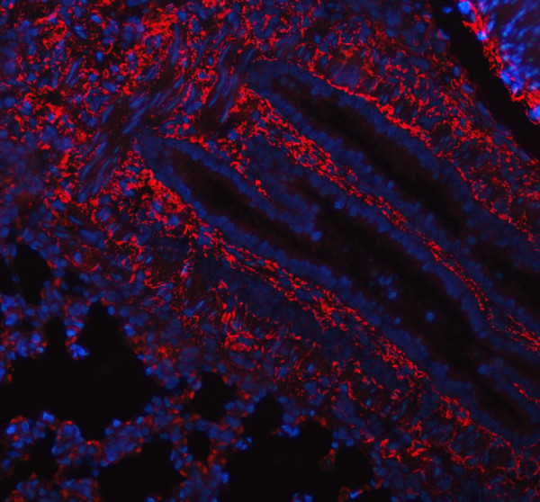 pa2140 2 col1a1 primary antibodies if testing 3