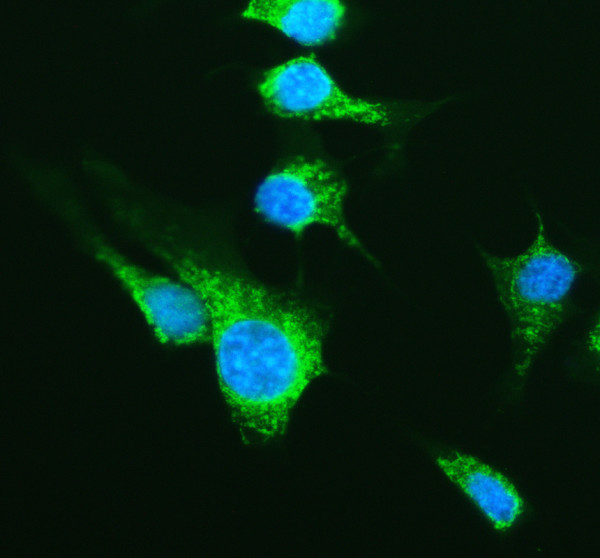 pa2140 2 col1a1 primary antibodies if testing 4