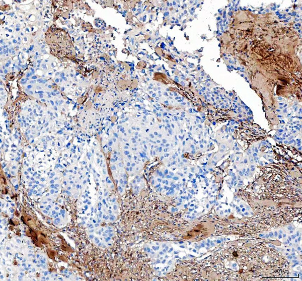 pa2140 2 col1a1 primary antibodies ihc testing 1