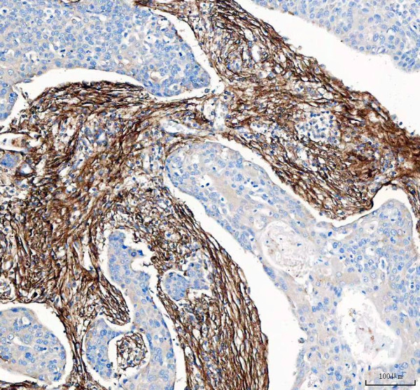 pa2140 2 col1a1 primary antibodies ihc testing 2_1