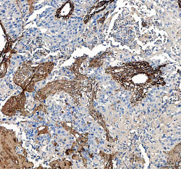 pa2140 2 col1a1 primary antibodies ihc testing 3