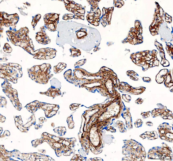 pa2140 2 col1a1 primary antibodies ihc testing 4_1