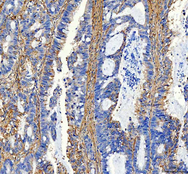 pa2140 2 col1a1 primary antibodies ihc testing 5_1_1
