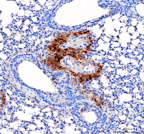 pa2140 2 col1a1 primary antibodies ihc testing 6_1