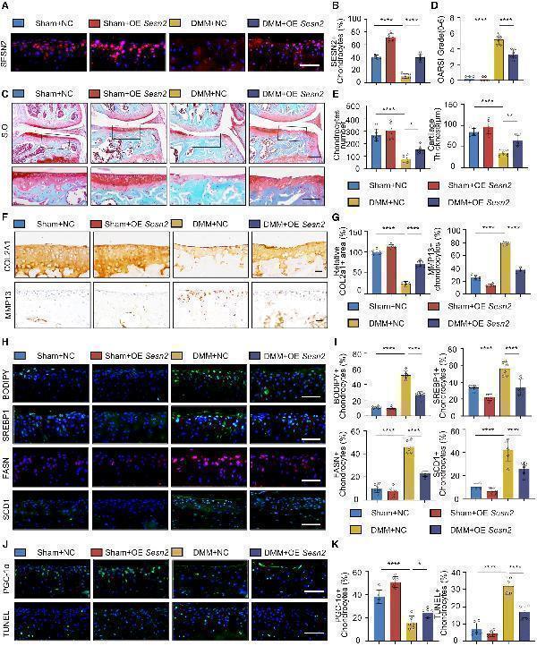 SESN2 overexpression improves fatty acid metabolism disorders and ameliorates cartilage degeneration
(A and B) IF (A) and corresponding quantitative analysis (B) of SESN2 in the articular cartilage of mice induced by sham or destabilization of medial meniscus (DMM) surgery with intraarticular injection of lv-nc and lv-Sesn2 (n = 6)