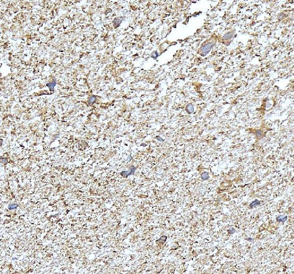 pa2148 ndrg2 primary antibodies ihc testing 1
