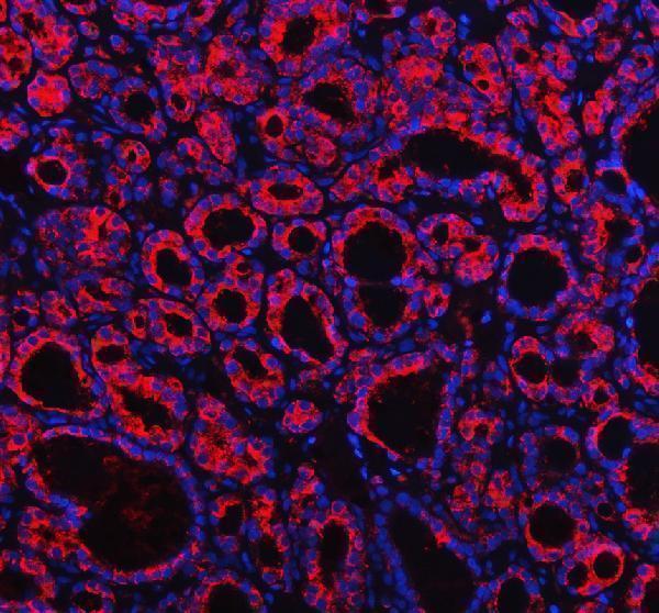 pa2162 pfn2 primary antibodies if testing 1