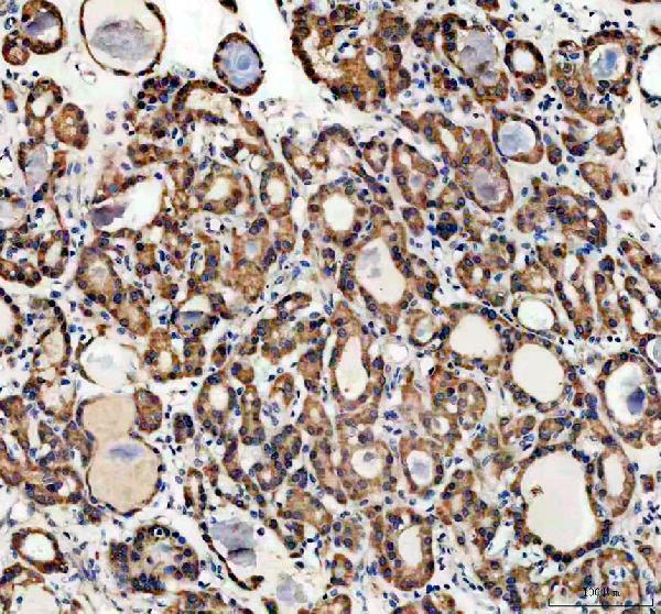 pa2162 pfn2 primary antibodies ihc testing 1