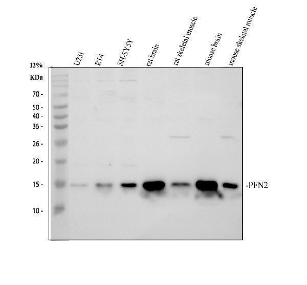 pa2162 pfn2 primary antibodies wb testing 1