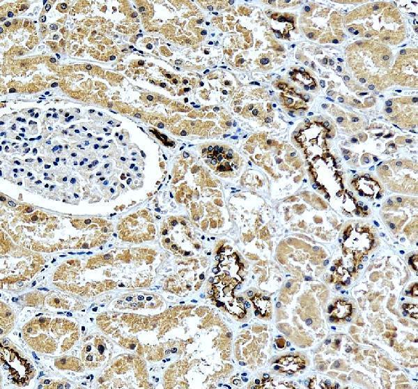 IHC analysis of SLC12A1 using anti-SLC12A1 antibody (PA2168)