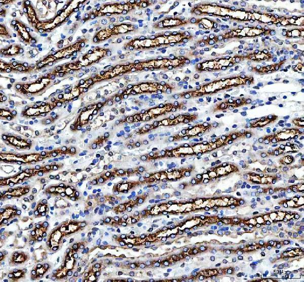 IHC analysis of SLC12A1 using anti-SLC12A1 antibody (PA2168)
