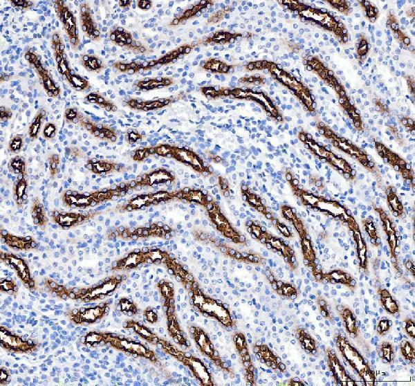 pa2168 slc12a1 primary antibodies ihc testing 3