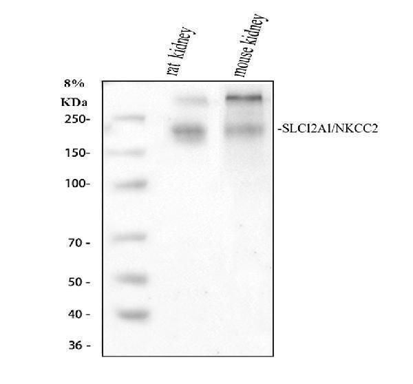 Western blot analysis of SLC12A1 using anti-SLC12A1 antibody (PA2168)