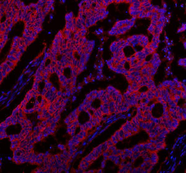 pa2169 slc12a2 primary antibodies if testing 5