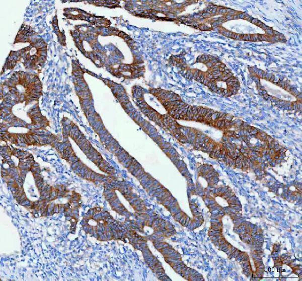 pa2169 slc12a2 primary antibodies ihc testing 2