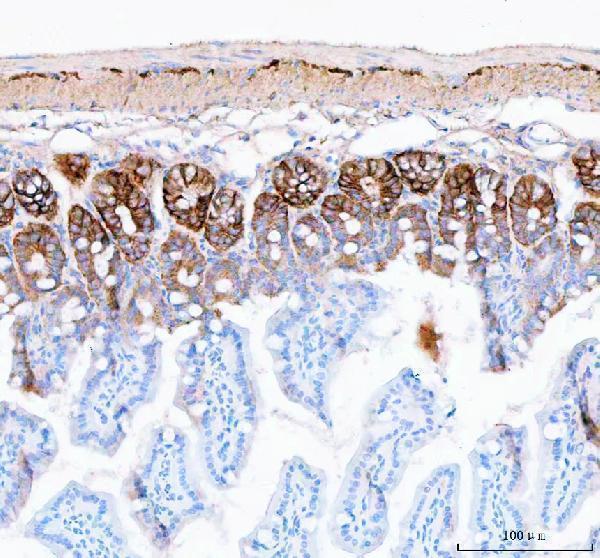 pa2169 slc12a2 primary antibodies ihc testing 3